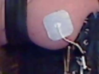 Elektrisch stimulation von recht brust